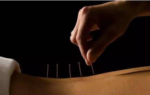 平衡針灸最新視頻，現代應用探索針灸藝術的新境界