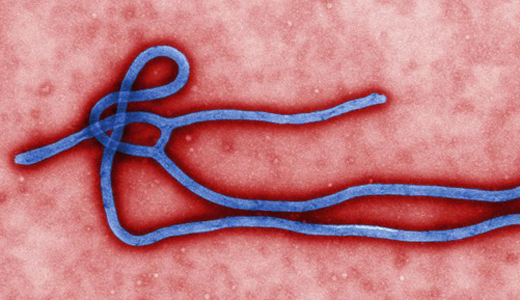 警惕最新病毒病人，你需要了解這些關(guān)鍵信息！