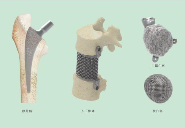 三維打印髖關(guān)節(jié)技術(shù)新動(dòng)態(tài)，重塑生活的科技魔法奇跡