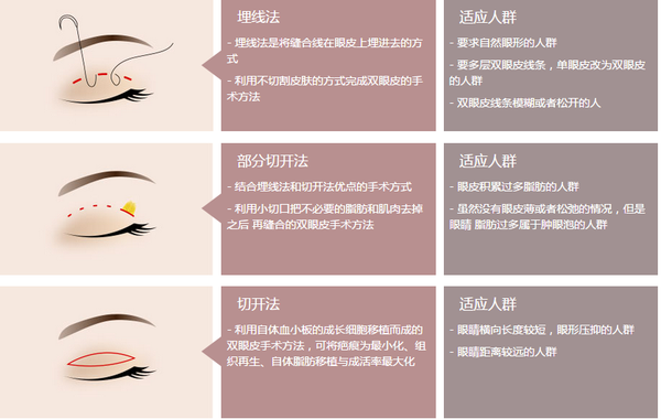 眼部整形最新技術揭秘