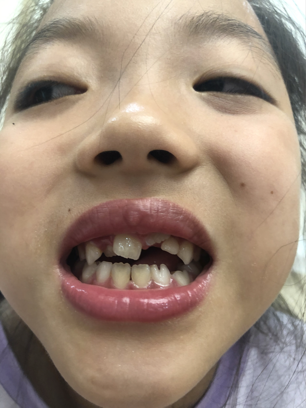 莊最新牙齒技術(shù)揭秘，牙齒美容新選擇