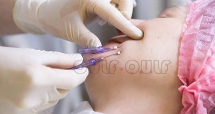 線雕最新手法，背景、發(fā)展、時代地位及展望